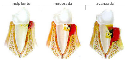 periodoncia gipuzkoa