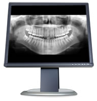 radiologia digital zumarraga